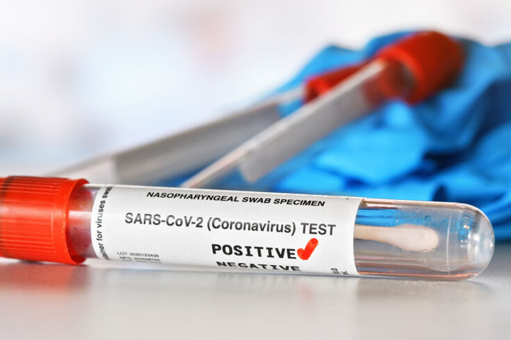 Coronavirus test concept - vial sample tube with cotton swab, red checkmark next to word positive, blurred vials and blue nitrile gloves background.