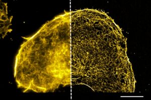 Liver cell image with half shown in standard resolution and half show in NanoImaging super resolution.